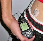 Diabetic Woman Claims Ham's Transmitter Causes Insulin Pump to Fail - RF Cafe