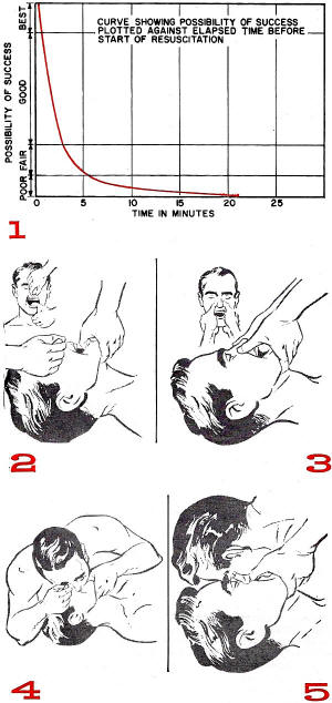 Resuscitation for Electric Shock (steps 1-5), December 1959 Electronics World - RF Cafe