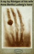 First X-ray by Röntgen of his wife Anna Bertha Ludwig's hand (Wikipedia) - RF Cafe